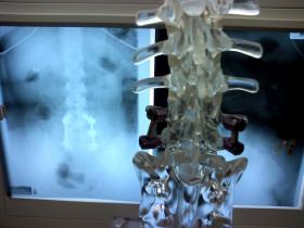 X-ray of the lumbar