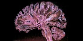 A purple brain
